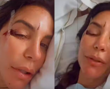 Ivete Sangalo tranquiliza fãs após desmaio e mostra ferimentos no hospital