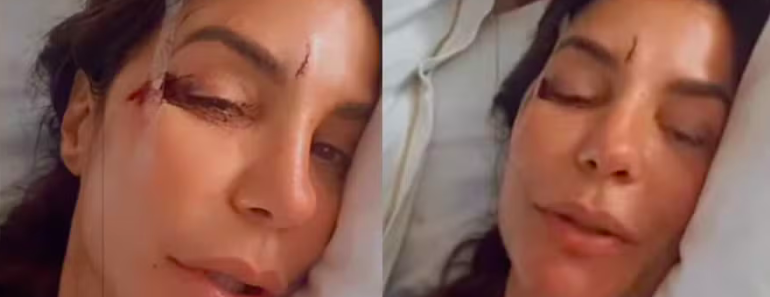 Ivete Sangalo tranquiliza fãs após desmaio e mostra ferimentos no hospital